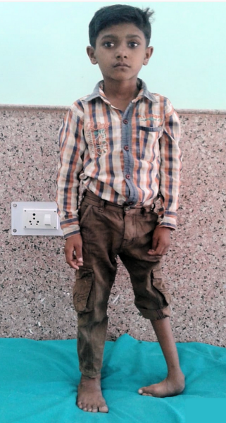 M. Akram Before Treatment