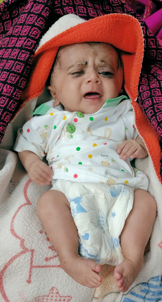 Jessica before Treatment